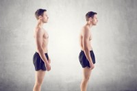 Anterior pelvic tilt and back pain.